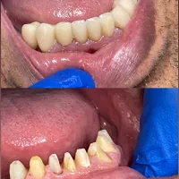 دندانپزشکی در آخونی|خدمات آرایشگری و زیبایی|تبریز, |دیوار