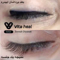 مدل ریموو تتو ابرو،خط چشم و خط لب|خدمات آرایشگری و زیبایی|رشت, بلوار گیلان|دیوار