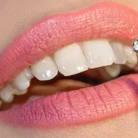 دندانپزشکی زیبایی و درمان با تخفیف ویژه افتتاحیه|خدمات آرایشگری و زیبایی|کرج, اصفهانی‌ها|دیوار