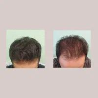 چرا راه دشوار تا وقتی که راه ساده تری هست