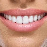 مدل جهت ونیر کامپوزیت