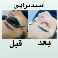 پاکسازی پوست به صورت حرفه ای فقط ۴۰۰ت