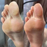 پدیکور بیتا