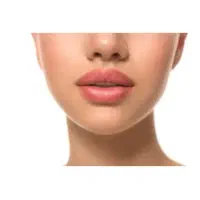 بوتاکس تخفیف ویژه ۸۰۰ ژل لب از ۱۸۰۰