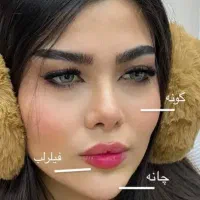 مدل ژل و بوتاکس
