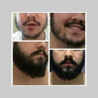 پرپشتی ریشاتو تو آیینه ببین