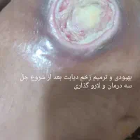 بخیه و تزریقات و پانسمان پیشرفته|خدمات آرایشگری و زیبایی|اهواز, منازل کارون|دیوار