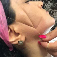 اصلاح کارم بسیار فوری سالن درمحدوده توضیحات
