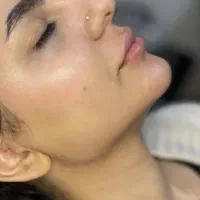 زیبایی لیفت بلفارو فرم بینی بوتاکس نخ ابروزاویه ژل|خدمات آرایشگری و زیبایی|اصفهان, بهارستان|دیوار