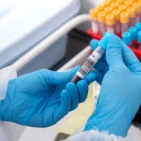 تفسیرو مشاوره تخصصی جواب آزمایش‌ ژنتیک و زنان