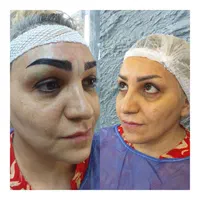 تزریقات ژل بوتاکس..  کاشت ابرو .ومو|خدمات آرایشگری و زیبایی|اسلام‌شهر, باغ فیض|دیوار