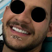 کامپوزیت زیبایی دندان|خدمات آرایشگری و زیبایی|صحنه, |دیوار