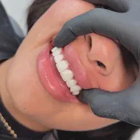 خدمات کامل دندانپزشکی|آرایشی، بهداشتی، درمانی|شیراز, فرهنگ شهر|دیوار