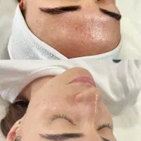 فشیال|خدمات زیبایی و سلامت|رشت, جهاد|دیوار