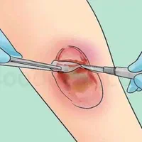 لوازم زخم بسترودرمان|آرایشی، بهداشتی، درمانی|کلاردشت, |دیوار