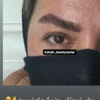 مدل بوتاکس و پی ار پی و کانتورینگ صورت با فیلر|خدمات آرایشگری و زیبایی|اصفهان, ملک‌شهر|دیوار