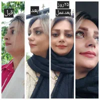 متخصص جراح زیبایی گوش وحلق وبینی|خدمات آرایشگری و زیبایی|قائمشهر, |دیوار