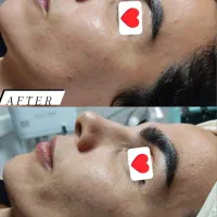فیشیال تخصصی