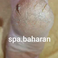 اسپا پدیکور کاملا تخصصی  و پارافین تراپی|خدمات آرایشگری و زیبایی|سنندج, |دیوار