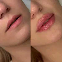 عکاسی پیج مطب