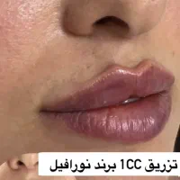 زیبایی لیفت بلفارو فرم بینی بوتاکس نخ ابروزاویه ژل|خدمات آرایشگری و زیبایی|اصفهان, بهارستان|دیوار