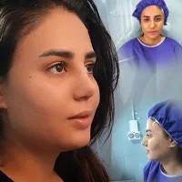 جراحی بینی ویژه مراجعین مهاباد در تهران/۴۲میلیون