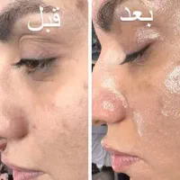 فشیال ۴۶۹ تخفیف ویژه