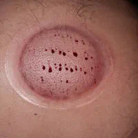 حجامت|خدمات آرایشگری و زیبایی|زاهدان, |دیوار