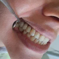 دندانپزشکی ایمپلنت دندان