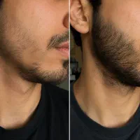 هزینه کم تر رویش بیشتر