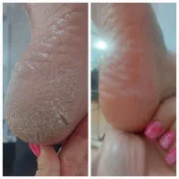 اپلاسیون تخصصی. پدیکور .ناخن ومژه وپاکسازی