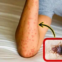 سمپاشی تضمینی یکساله سوسک ساس کنه موش کک(سم پاشی)