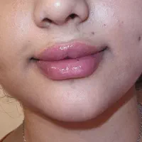 تزریق فیلر بادی بدن۱۲۰هزار|خدمات آرایشگری و زیبایی|جوانرود, |دیوار