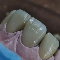 لابراتوار دندانسازی ثابت بلو دنت