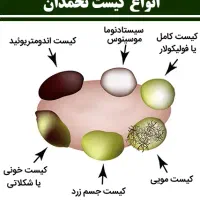 پاکسازی و بهبود رحم ،کیست،فیبروم و تنبلی تخمدان|آرایشی، بهداشتی، درمانی|گنبد کاووس, |دیوار