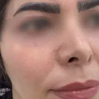 اماراتی ضدلک ترکیبی|آرایشی، بهداشتی، درمانی|خورموج, |دیوار