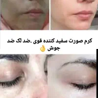کرم صورت و دست وپا|آرایشی، بهداشتی، درمانی|بندرعباس, |دیوار