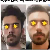 بمب چاقی صورت|خوردنی و آشامیدنی|شیراز, عفیف‌آباد|دیوار