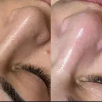 پاکسازی و فشیال تخصصی ۳۹۸تومن با قیمت ویژه بهاری