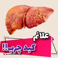 رفع و بهبود کبد چرب