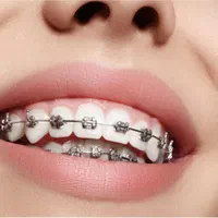 ارتودنسی|خدمات آرایشگری و زیبایی|اصفهان, خواجو|دیوار