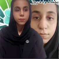 عمل زیبایی بینی در مازندران