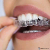 بلیچینگ خانگی یا نایت گارد