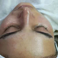 فیشال و پاکسازی پوست