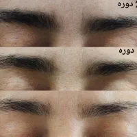 پرپشت کننده ی تضمینی مو ، مژه و ابرو