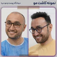 (+فیلم) کلینیک کاشت مو، ابرو و ریش|خدمات آرایشگری و زیبایی|تهران, صادقیه|دیوار