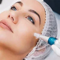 میکرونیدلینگ پوست صورت (مطب دکتر علی بابایی)