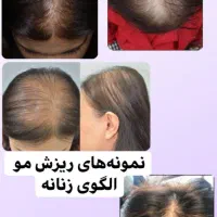 اسکالپ سر .کراتین وپروتین تراپی اپلاسیون بدن|خدمات آرایشگری و زیبایی|تنکابن, |دیوار