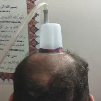 حجامت.زالودرمانی.فصدخون|خدمات آرایشگری و زیبایی|اسلامشهر, شهرک مهدیه|دیوار