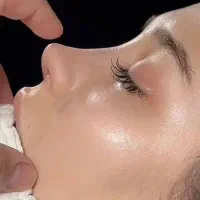 جراحی بینی در مشهد با قیمت منطقی توسط پزشک متخصص